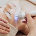 Apa yang Harus Diketahui Sebelum Melakukan Laser Wajah?