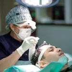 Cara Memilih Klinik Hair Transplant Terbaik