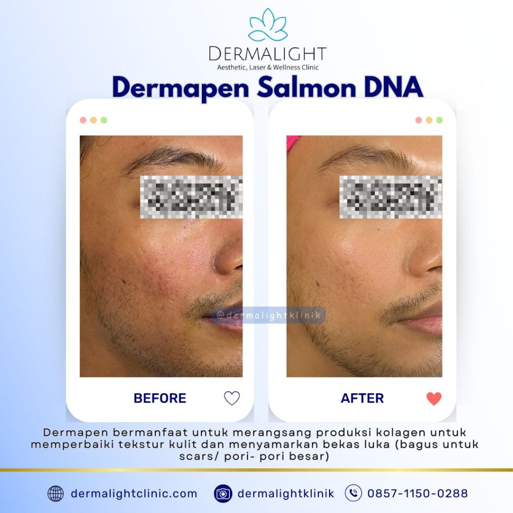 before after Dermalight Clinic Bogor