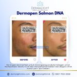 before after Dermalight Clinic Bogor