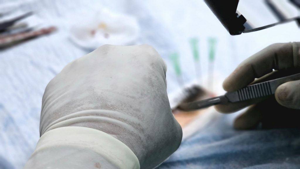Biaya Hair Transplant Indonesia Dermalight